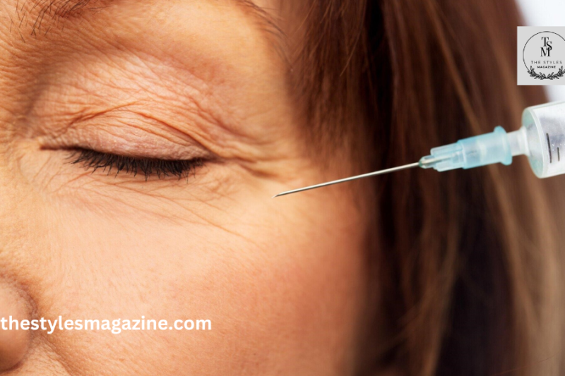 Top 4 Reasons To Choose Injectable Treatments For Eyelid Wrinkles