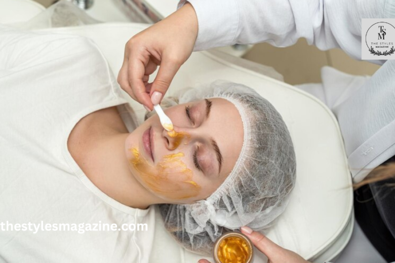 How To Prepare For Your First Chemical Peel For Acne: Tips And Tricks