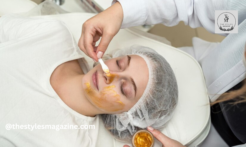 chemical peel for acne